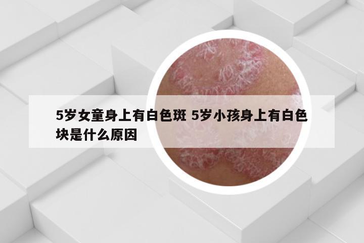 5岁女童身上有白色斑 5岁小孩身上有白色块是什么原因