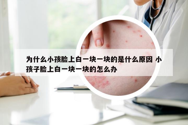 为什么小孩脸上白一块一块的是什么原因 小孩子脸上白一块一块的怎么办