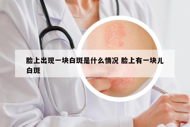 脸上出现一块白斑是什么情况 脸上有一块儿白斑