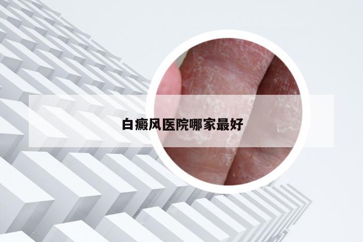 白癜风医院哪家最好