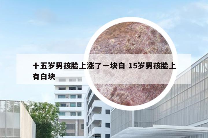十五岁男孩脸上涨了一块白 15岁男孩脸上有白块