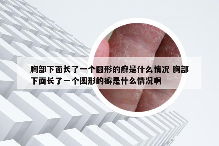 胸部下面长了一个圆形的癣是什么情况 胸部下面长了一个圆形的癣是什么情况啊