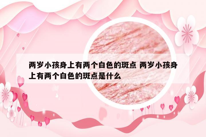 两岁小孩身上有两个白色的斑点 两岁小孩身上有两个白色的斑点是什么