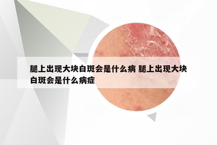 腿上出现大块白斑会是什么病 腿上出现大块白斑会是什么病症