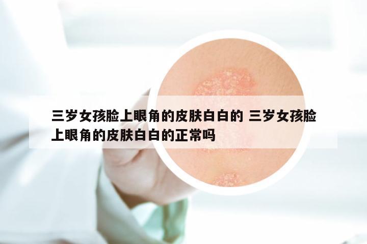 三岁女孩脸上眼角的皮肤白白的 三岁女孩脸上眼角的皮肤白白的正常吗