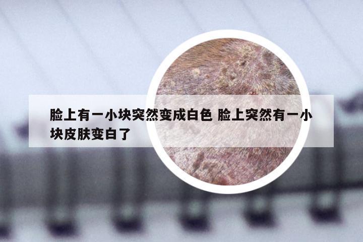 脸上有一小块突然变成白色 脸上突然有一小块皮肤变白了