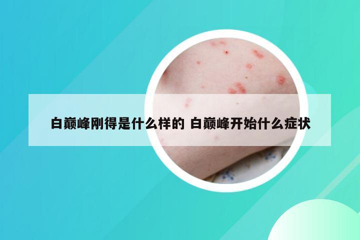 白巅峰刚得是什么样的 白巅峰开始什么症状