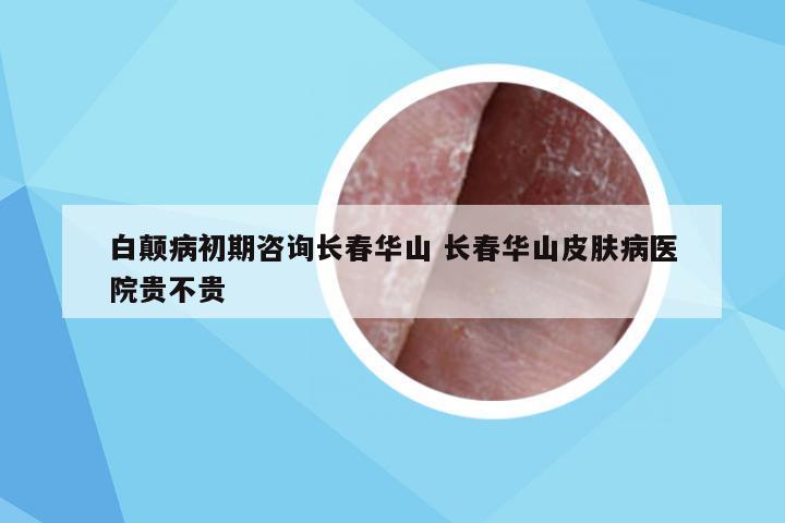 白颠病初期咨询长春华山 长春华山皮肤病医院贵不贵