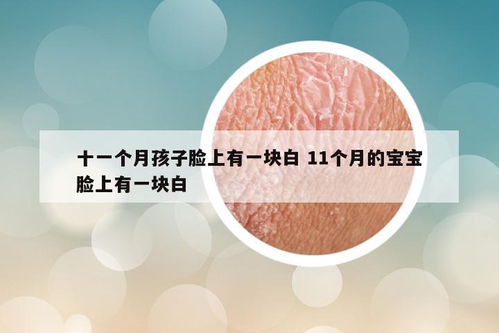 十一个月孩子脸上有一块白 11个月的宝宝脸上有一块白