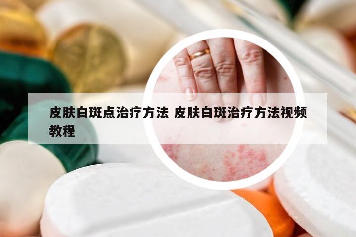 皮肤白斑点治疗方法 皮肤白斑治疗方法视频教程