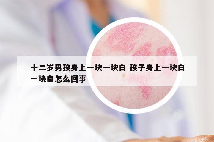 十二岁男孩身上一块一块白 孩子身上一块白一块白怎么回事