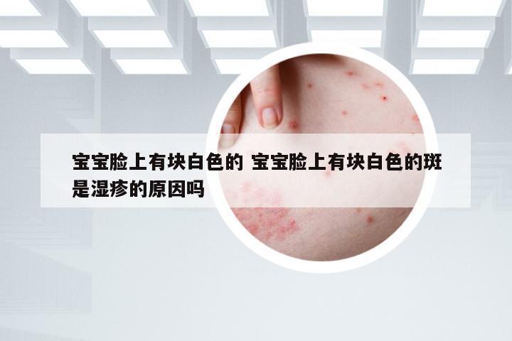 宝宝脸上有块白色的 宝宝脸上有块白色的斑是湿疹的原因吗
