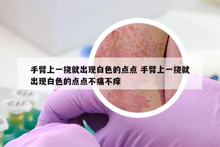 手臂上一挠就出现白色的点点 手臂上一挠就出现白色的点点不痛不痒