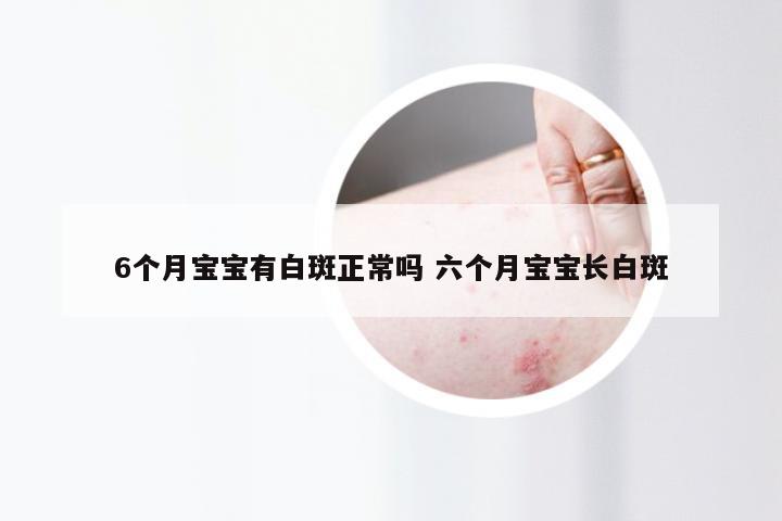 6个月宝宝有白斑正常吗 六个月宝宝长白斑