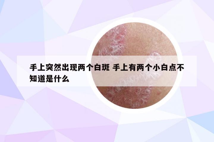 手上突然出现两个白斑 手上有两个小白点不知道是什么