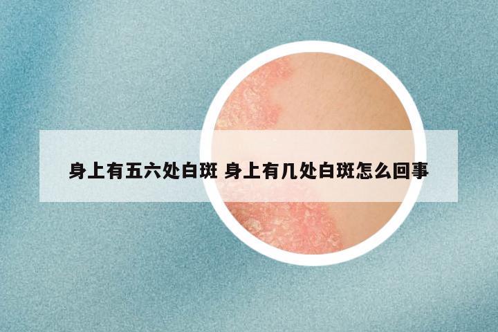 身上有五六处白斑 身上有几处白斑怎么回事