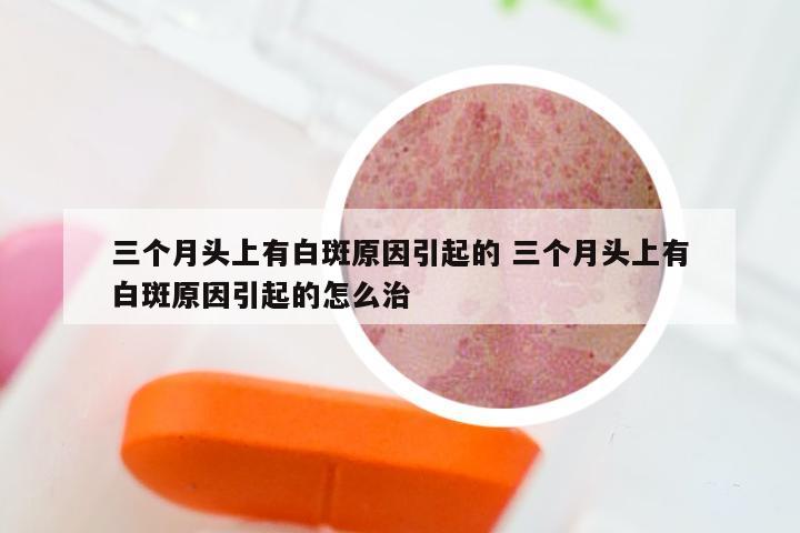 三个月头上有白斑原因引起的 三个月头上有白斑原因引起的怎么治