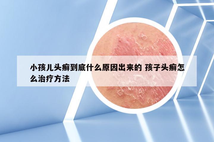 小孩儿头癣到底什么原因出来的 孩子头癣怎么治疗方法