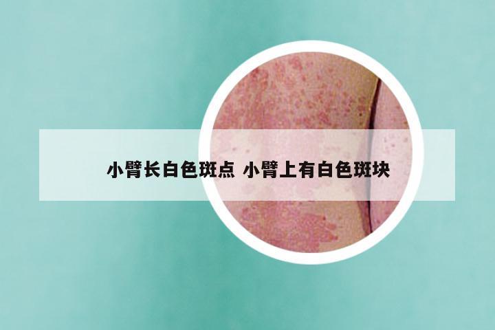 小臂长白色斑点 小臂上有白色斑块
