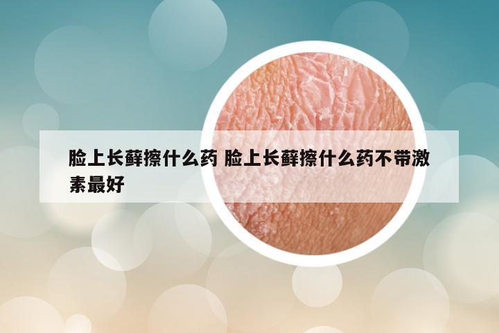 脸上长藓擦什么药 脸上长藓擦什么药不带激素最好