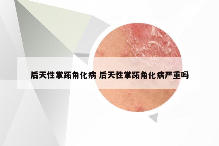 后天性掌跖角化病 后天性掌跖角化病严重吗