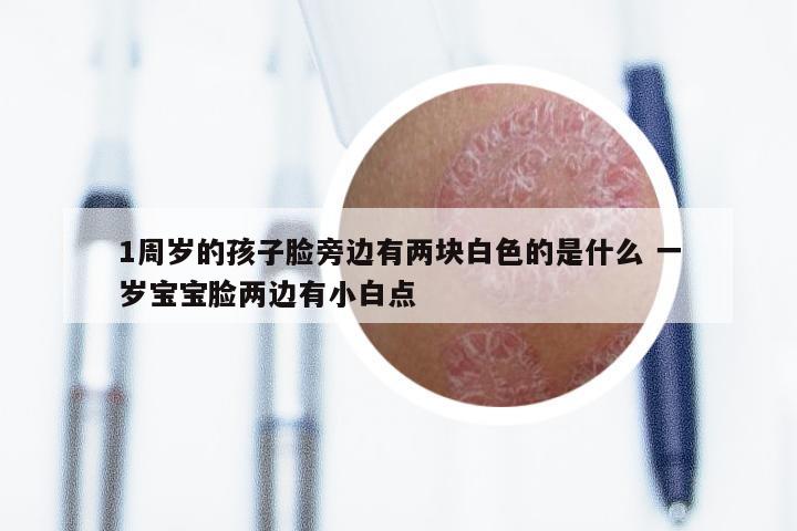 1周岁的孩子脸旁边有两块白色的是什么 一岁宝宝脸两边有小白点