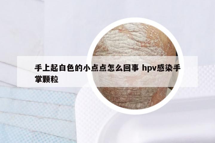 手上起白色的小点点怎么回事 hpv感染手掌颗粒