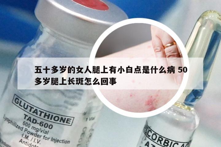 五十多岁的女人腿上有小白点是什么病 50多岁腿上长斑怎么回事