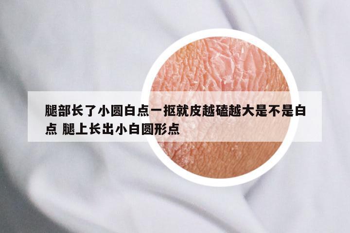腿部长了小圆白点一抠就皮越磕越大是不是白点 腿上长出小白圆形点