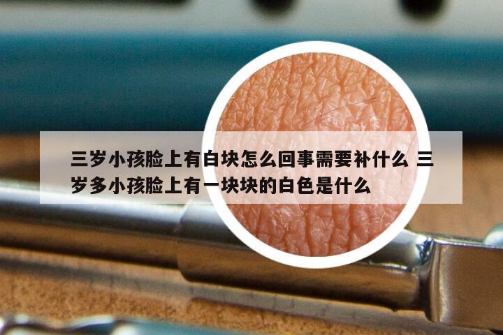 三岁小孩脸上有白块怎么回事需要补什么 三岁多小孩脸上有一块块的白色是什么