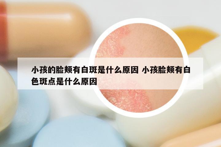 小孩的脸颊有白斑是什么原因 小孩脸颊有白色斑点是什么原因