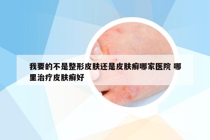 我要的不是整形皮肤还是皮肤癣哪家医院 哪里治疗皮肤癣好