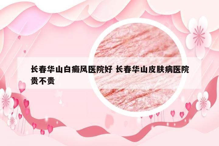 长春华山白癜风医院好 长春华山皮肤病医院贵不贵