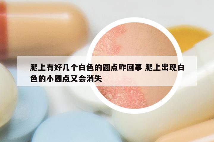 腿上有好几个白色的圆点咋回事 腿上出现白色的小圆点又会消失