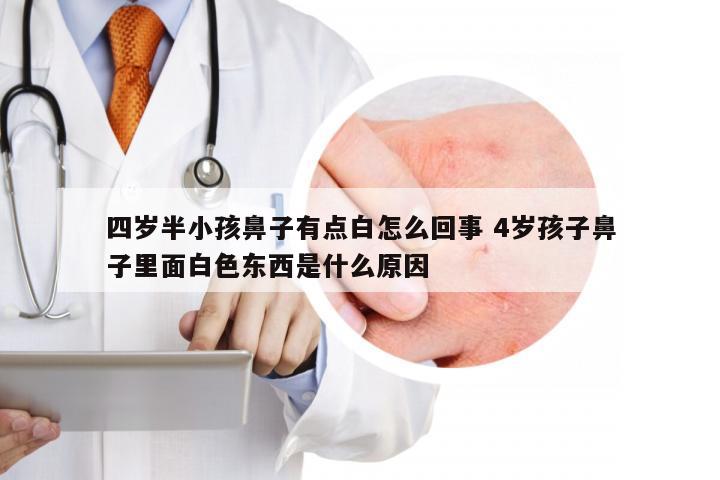 四岁半小孩鼻子有点白怎么回事 4岁孩子鼻子里面白色东西是什么原因
