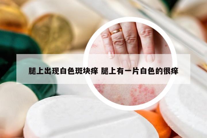 腿上出现白色斑块痒 腿上有一片白色的很痒