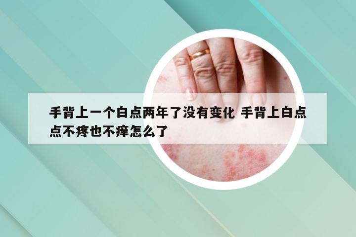手背上一个白点两年了没有变化 手背上白点点不疼也不痒怎么了