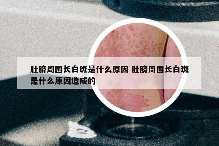 肚脐周围长白斑是什么原因 肚脐周围长白斑是什么原因造成的