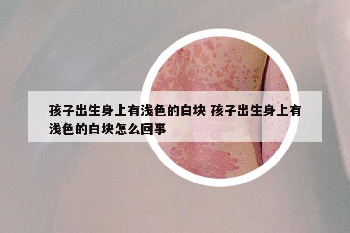 孩子出生身上有浅色的白块 孩子出生身上有浅色的白块怎么回事