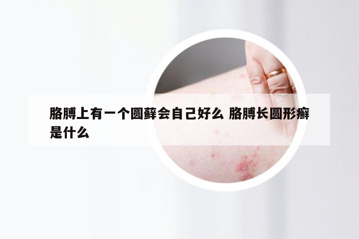 胳膊上有一个圆藓会自己好么 胳膊长圆形癣是什么