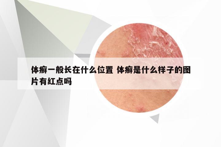 体癣一般长在什么位置 体癣是什么样子的图片有红点吗
