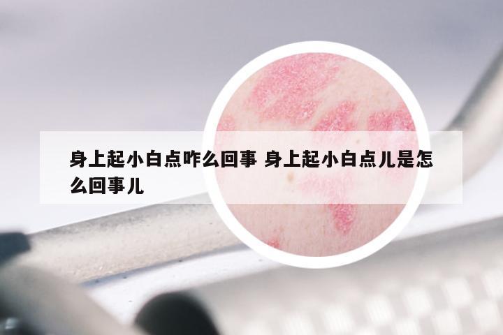 身上起小白点咋么回事 身上起小白点儿是怎么回事儿