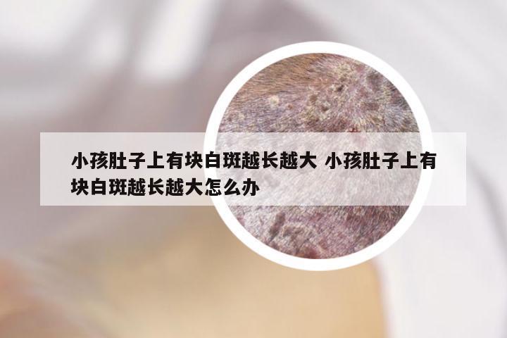 小孩肚子上有块白斑越长越大 小孩肚子上有块白斑越长越大怎么办