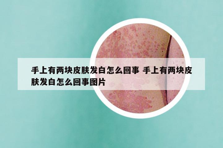 手上有两块皮肤发白怎么回事 手上有两块皮肤发白怎么回事图片