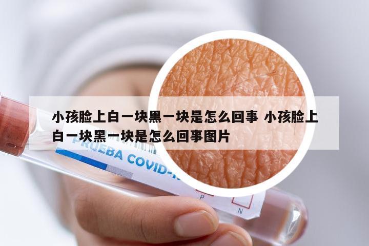 小孩脸上白一块黑一块是怎么回事 小孩脸上白一块黑一块是怎么回事图片