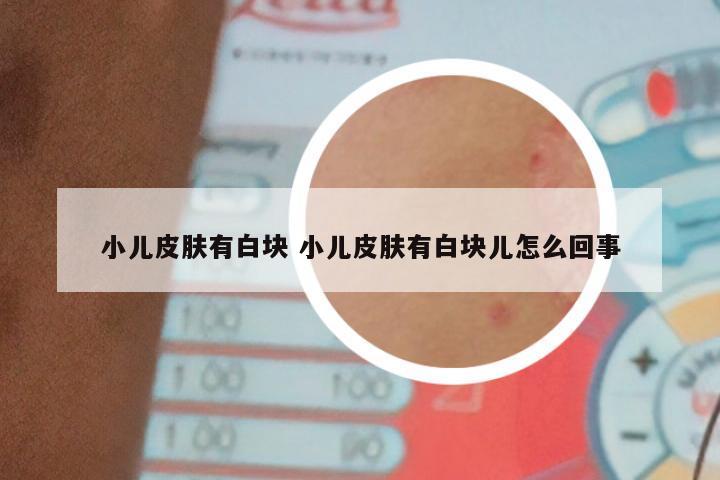 小儿皮肤有白块 小儿皮肤有白块儿怎么回事