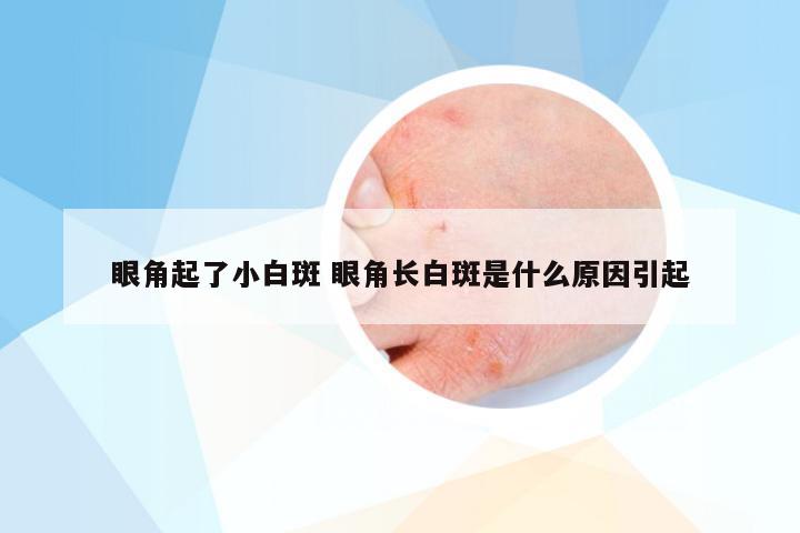 眼角起了小白斑 眼角长白斑是什么原因引起