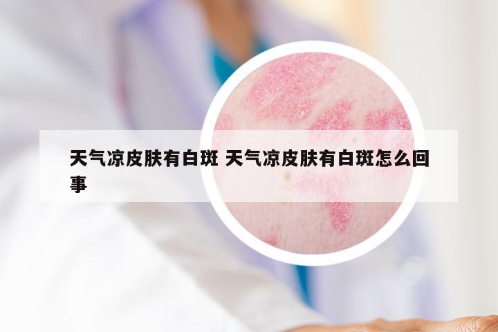 天气凉皮肤有白斑 天气凉皮肤有白斑怎么回事