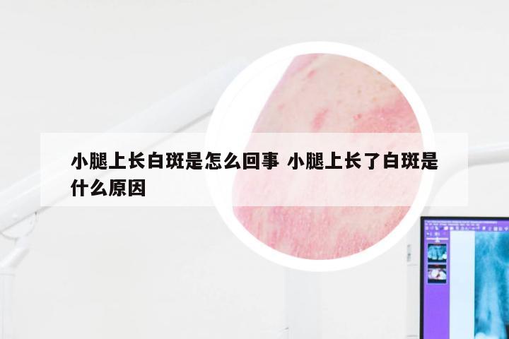 小腿上长白斑是怎么回事 小腿上长了白斑是什么原因