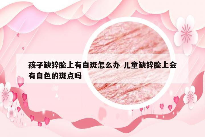 孩子缺锌脸上有白斑怎么办 儿童缺锌脸上会有白色的斑点吗
